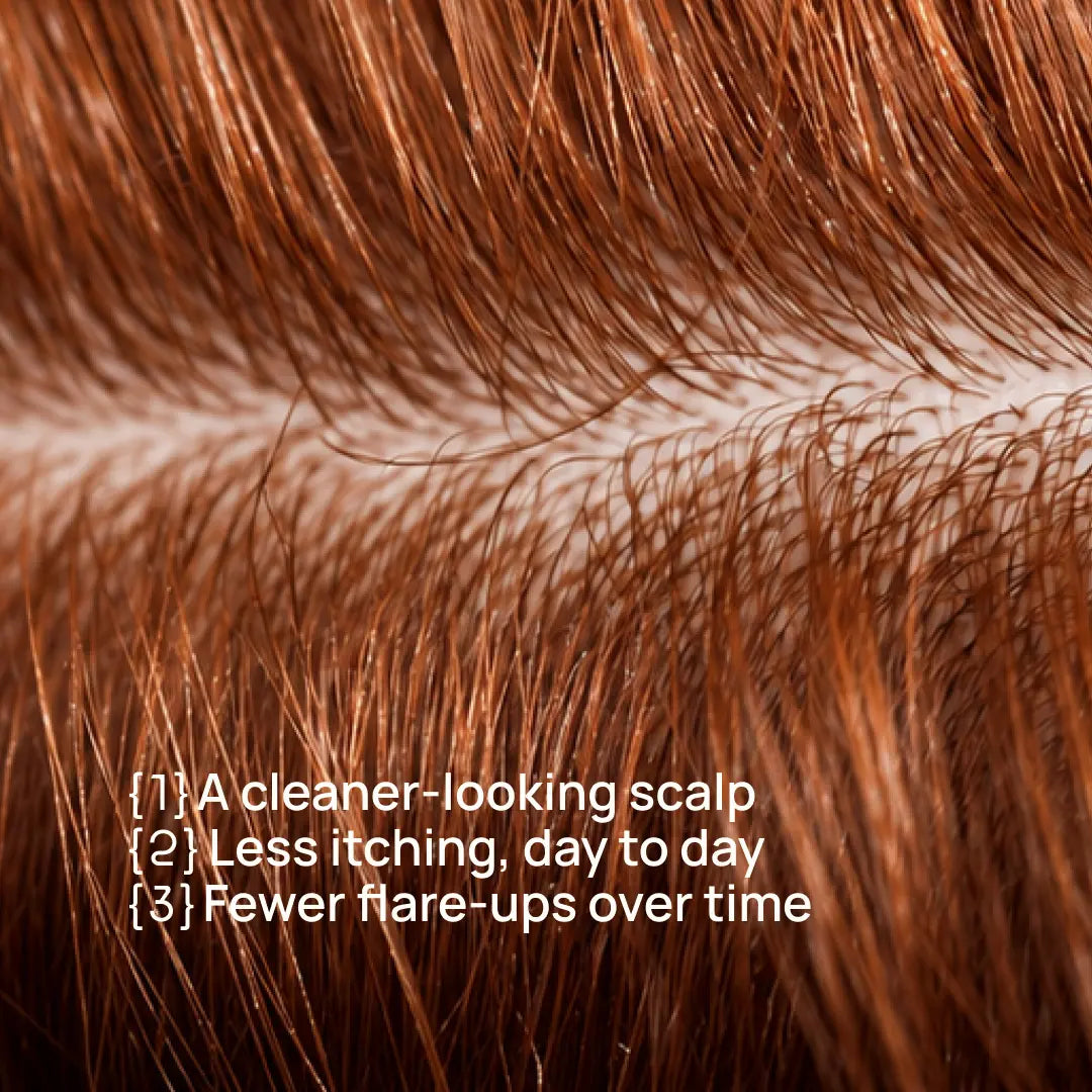 Close-up of coppery brown hair with white text listing benefits: '1) A cleaner-looking scalp 2) Less itching, day to day 3) Fewer flare-ups over time'.