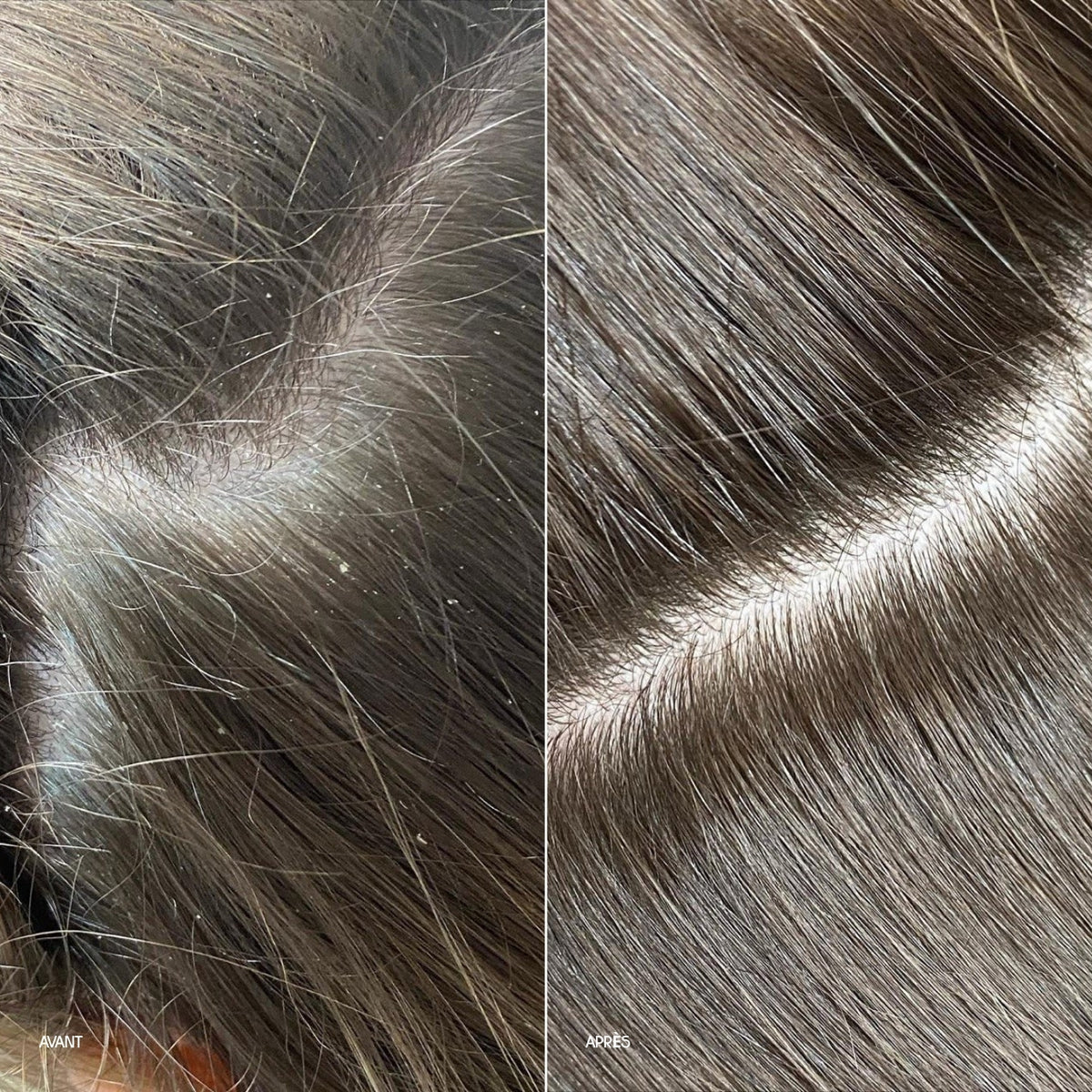 ANTI-DANDRUFF PREBIOTIC SERUM