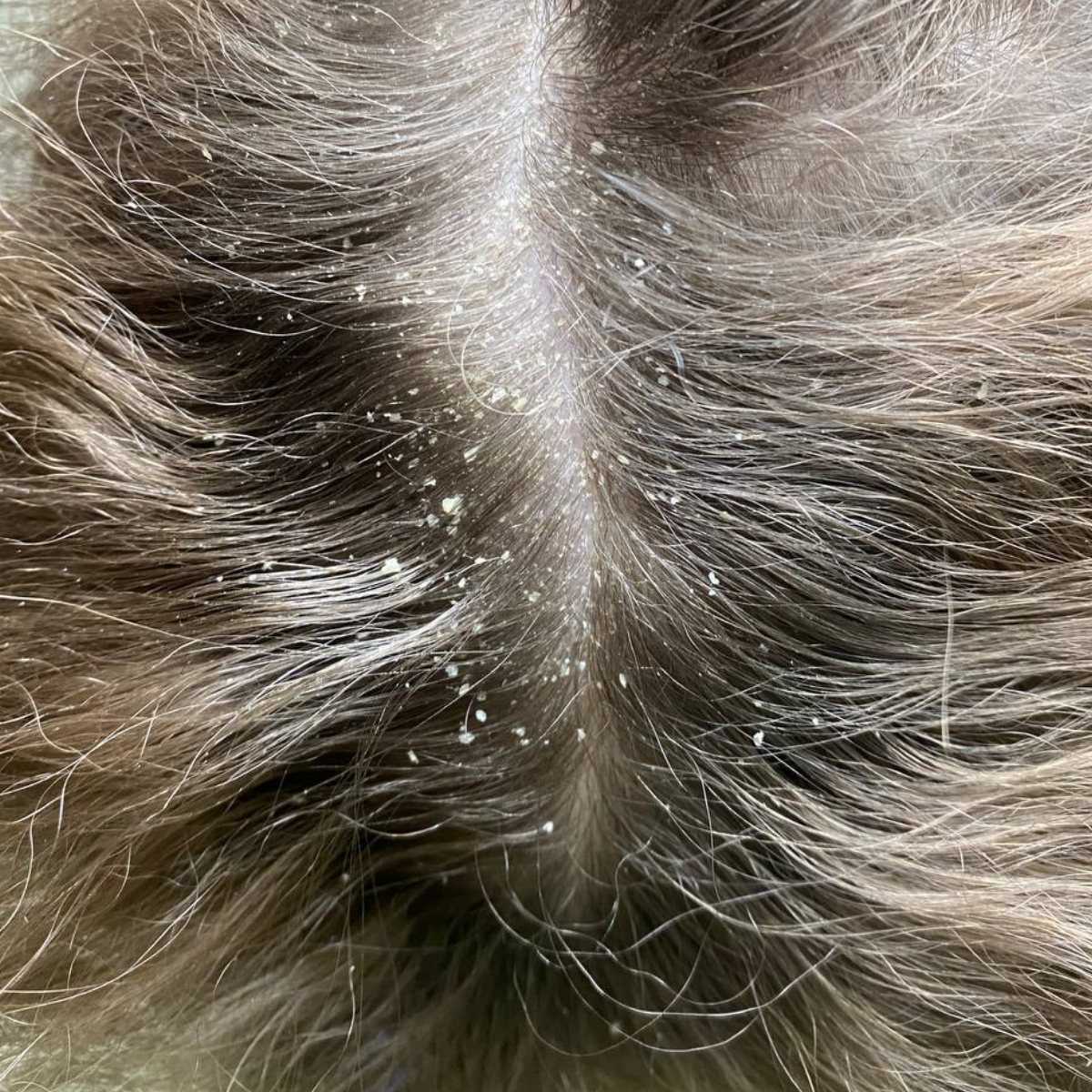 Close-up of a dog's dark brown and gray hair with visible dandruff flakes and dry scalp on the crown.
