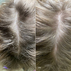 Before and after comparison of hair care product on scalp