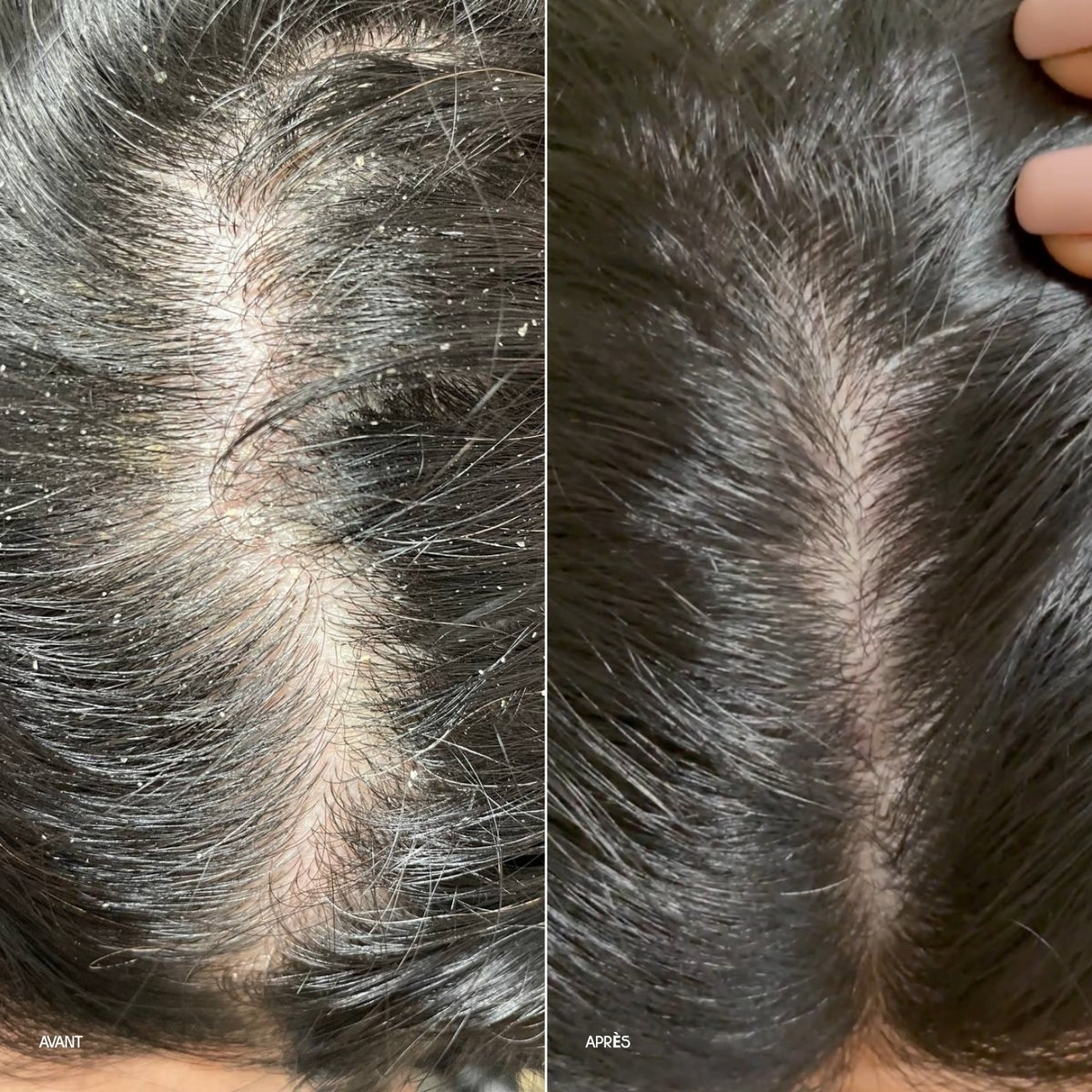 Before and after comparison of hair care product application on scalp