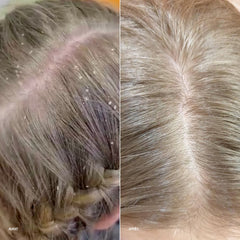 Before and after comparison of hair treatment on a person's head.