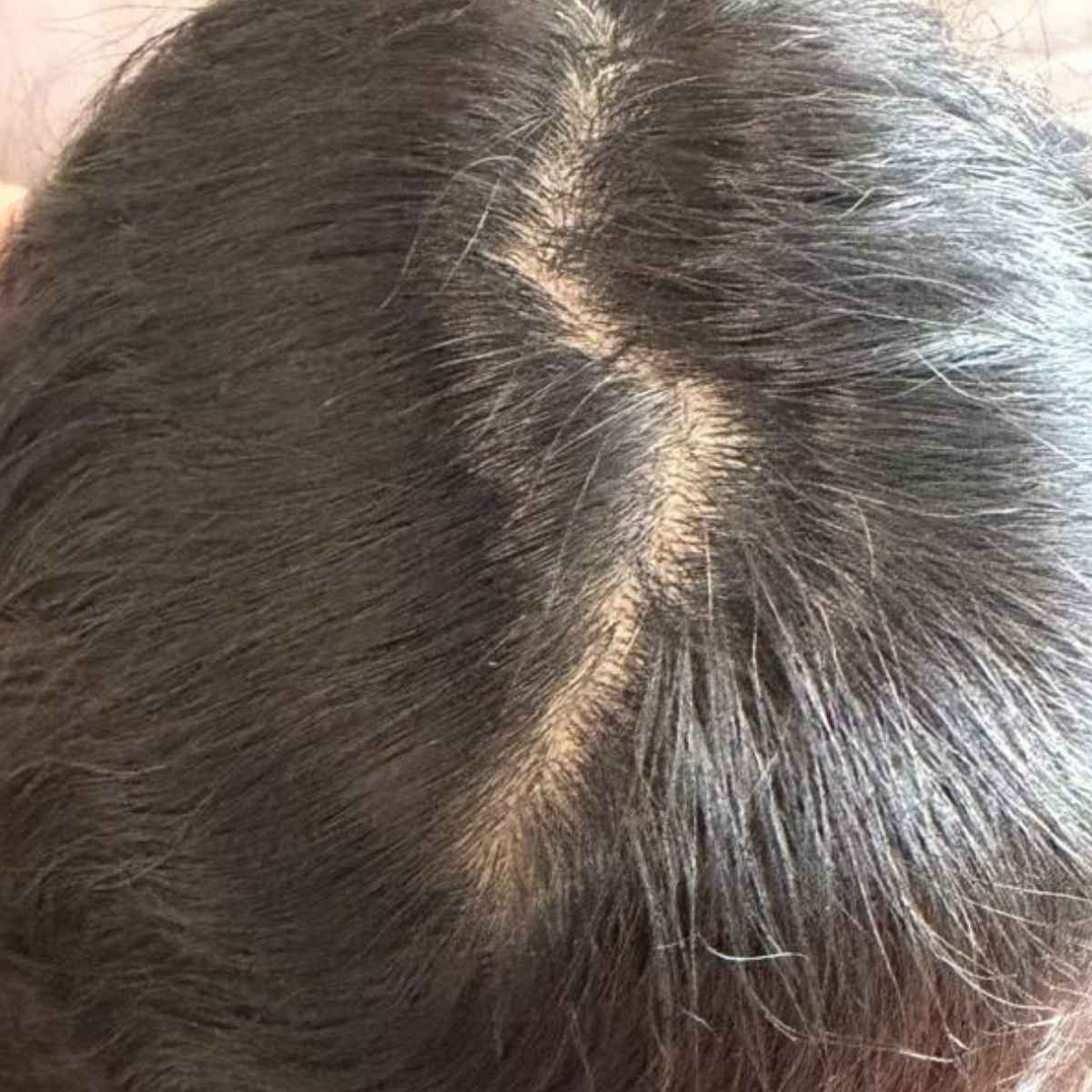 Close-up of a person's dark brown to black hair with a visible part line and fine hair strands.
