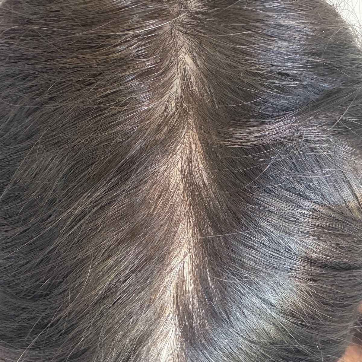 Close-up of dark brown to black hair parted down the center, showing fine strands and a light scalp ridge.
