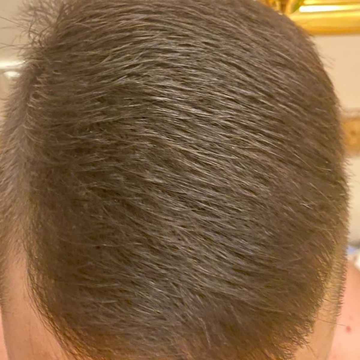 Close-up view of a person's dark brown to gray hair from the top, showing the texture and color of the hair.
