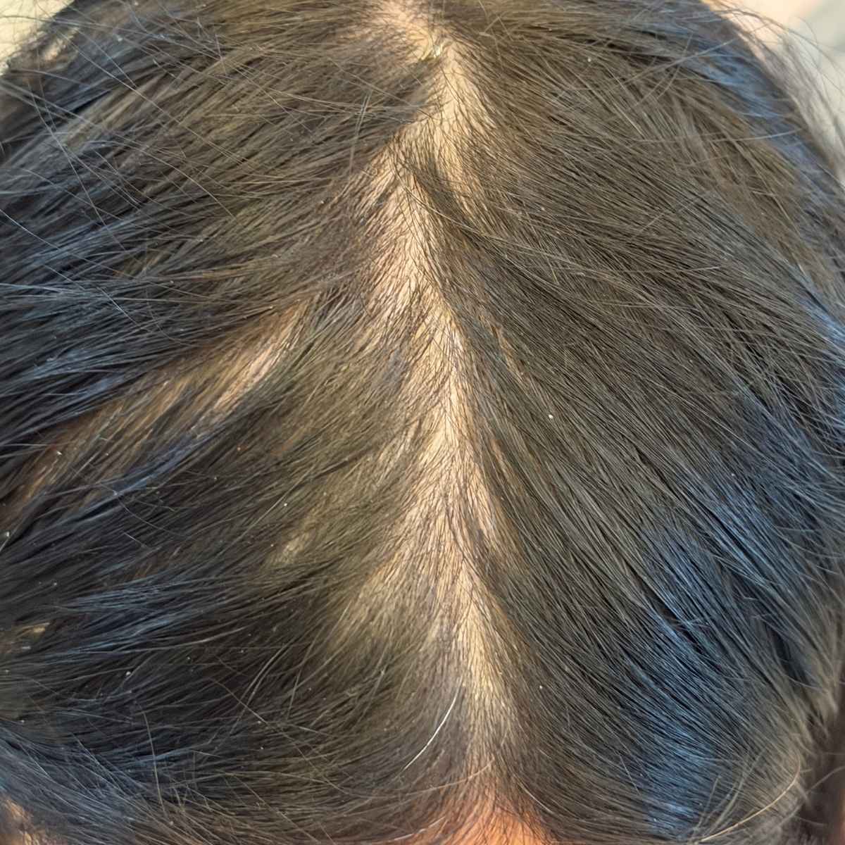 Close-up view of a person's dark brown to black hair parted down the center, showing scalp texture and hair strands.